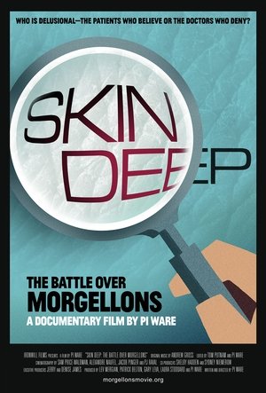 Skin Deep: The Battle Over Morgellons Poster